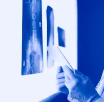İnvaziv radioloq nədir - İnvaziv radiologiya haqqında! İnvaziv radioloq nədir - İnvaziv radiologiya haqqında!